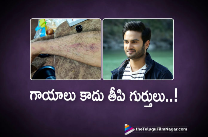2019 Latest Telugu Film News, Telugu Film Updates, Telugu Filmnagar, Tollywood Cinema News, Sudheer Babu Injured on the Sets of V Movie, Sudheer injured on the V Movie sets , Sudheer Babu Injured, Sudheer Babu Latest Movie News, V movie Shooting Updates, Sudheer Babu Starrer V Movie Latest News