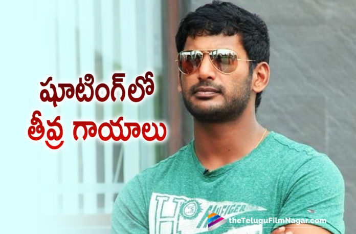 Actor Vishal Gets Seriously Injured During The Shoot Of An Action Sequence,Telugu Filmnagar,Vishal,Thu Pa Saravanan,Yuvan Shankar Raja,Vishal Film Factory,Vishal,Vishal New Movie,Vishal31,Vishal 31 Movie,Vishal Movie,Vishal Next Movie,Vishal Movie 2021,Yuvan Shankar,New Vishal Movie,Vishal Movies,Actor Vishal,Vishal Upcoming,Vishal Upcoming Movie,Vishal Upcoming Movies,Not A Common Man,Vishal 31 Not A Common Man,Vishal 31 Movie Update,Vishal 31 Film Update,Vishal 31 Not A Common Man,#Vishal31,#NotACommonMan,Vishal Risky Stunt For Vishal 31,Vishal,Actor Vishal,Hero Vishal,Vishal Latest Movie,Vishal Next Project,Vishal Upcoming Projects,Vishal 31 Movie News,Vishal 31 Shoot,Vishal New Movie Shoot,Vishal31 Movie Stunt Video,Vishal Video,Vishal Stunt Video,Telugu Filmnagar,Vishal Gets Injured,Vishal Action Sequence,Not A Common Man Movie,Not A Common Man Movie Update,Vishal Not A Common Man Action Sequence,Hero Vishal Back Injured At Movie Shooting In Action Sequens,Action Sequens,Back Injured,Hero Vishal,Hyderabad Shooting,Movie Shooting,News,Vishal Gets Injured While Shooting An Action Sequence,Actor Vishal Gets Injured While Shooting Not A Common Man,Vishal Gets Injured While Shooting For Vishal 31
