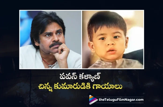 AP Deputy CM Pawan Kalyan Son Mark Shankar Injured in Fire Mashup